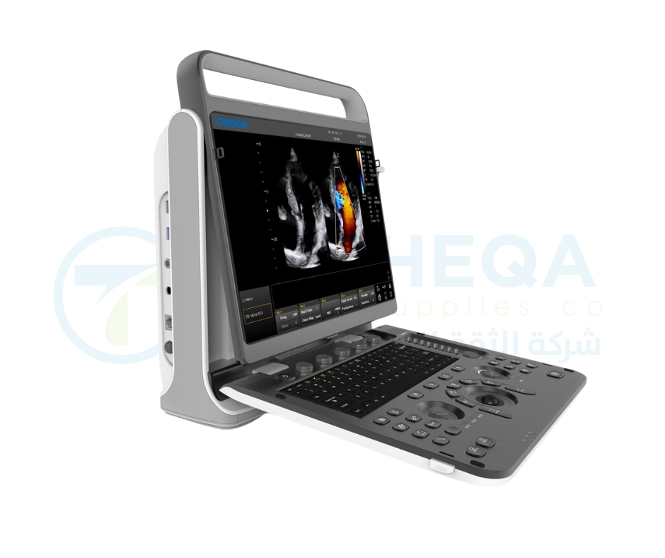 Chison Ultrasound EBit 60