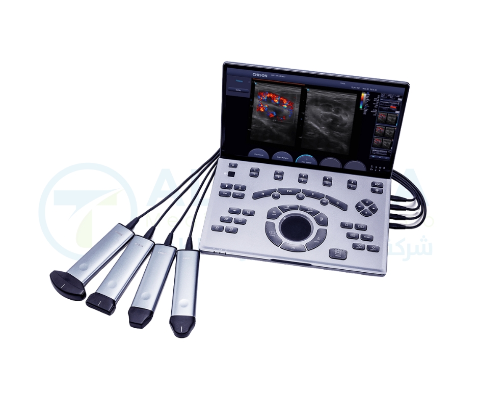 Chison Ultrasound SonoAir 30