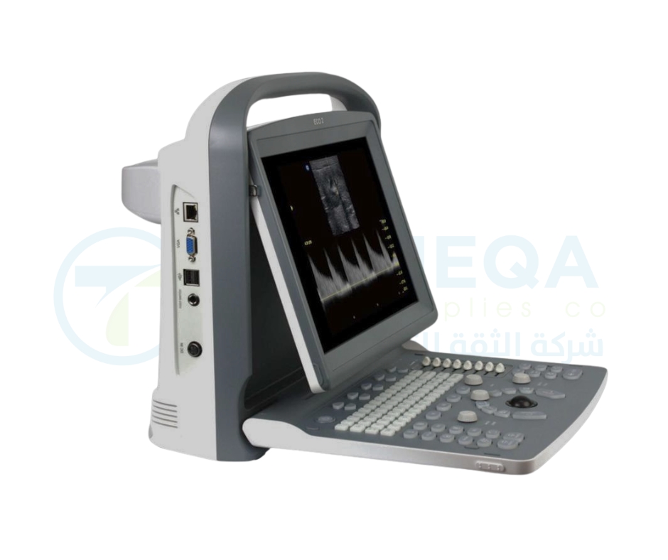 Chison Ultrasound ECO 2
