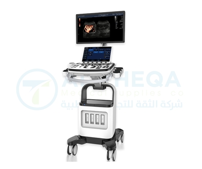 Chison Ultrasound XBit 90