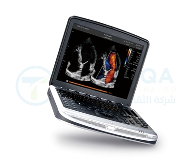 Chison SonoBook 8
