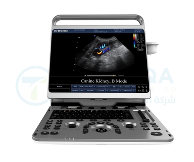 Chison Ultrasound EBit 50