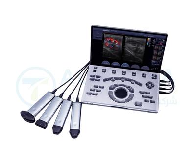 Chison Ultrasound SonoAir 30