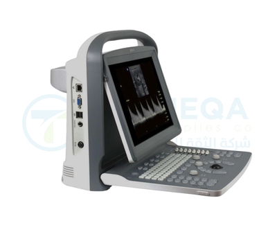 Chison Ultrasound ECO 2