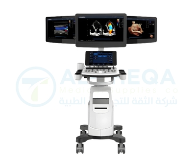Chison Ultrasound CBIT 6