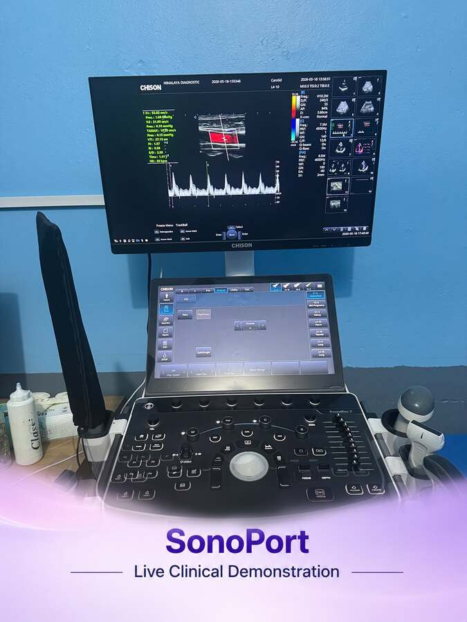Chison Ultrasound SonoPort 8