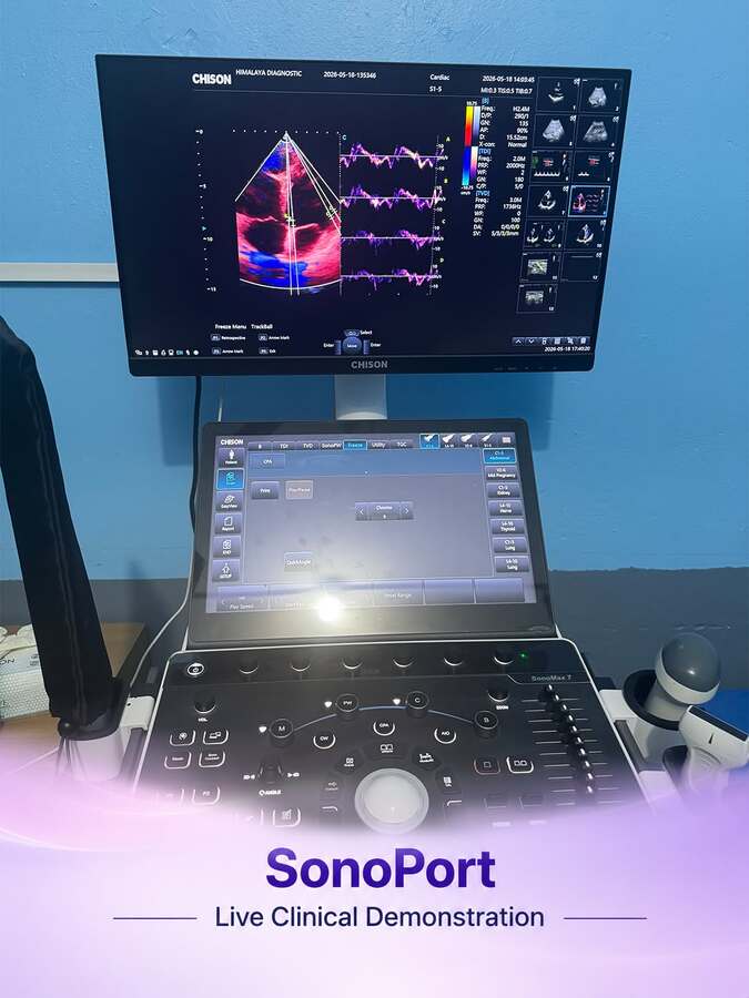 Chison Ultrasound SonoPort 8