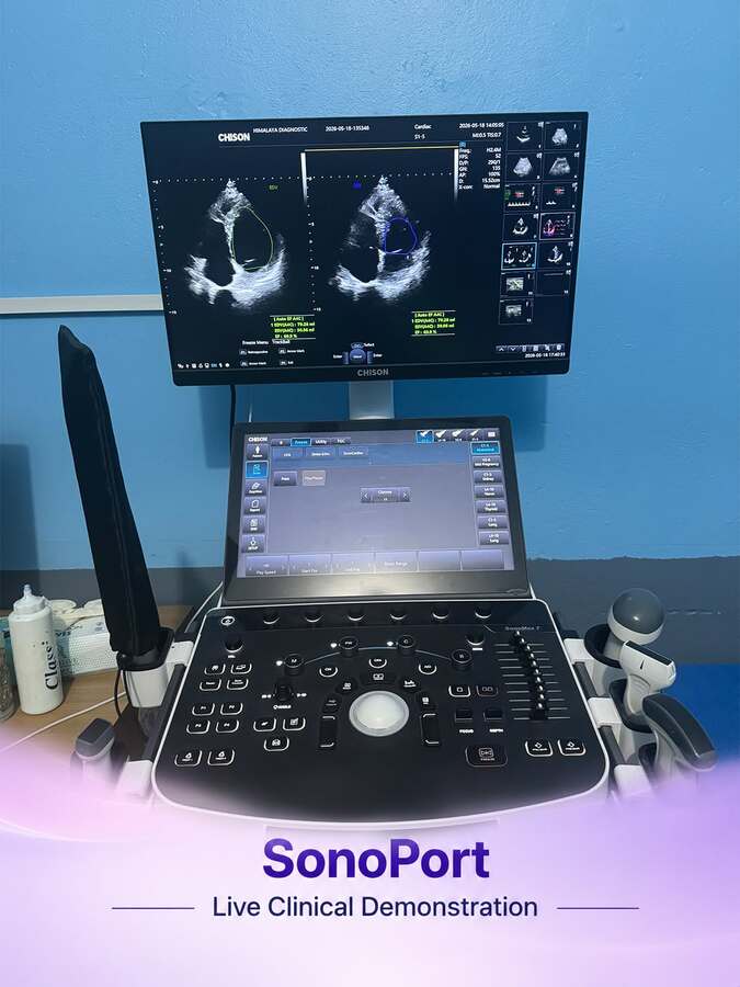 Chison Ultrasound SonoPort 8